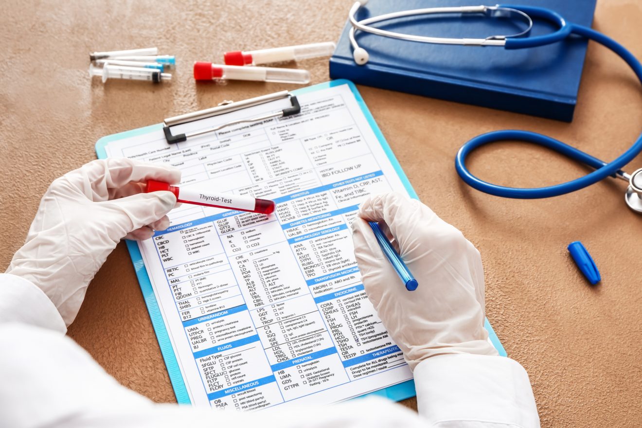 How Much Time It Takes To Get Thyroid Blood Test Results